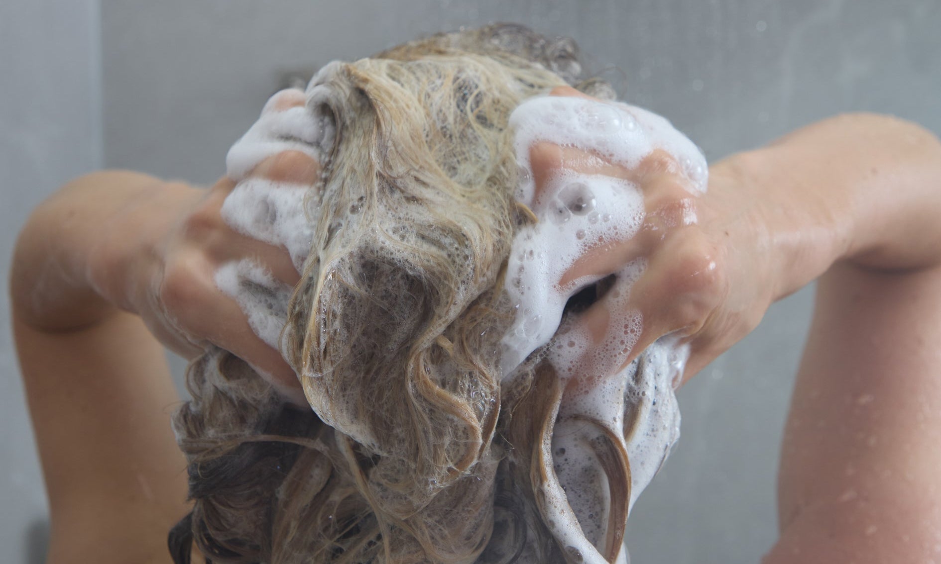 What Causes Hair Thinning